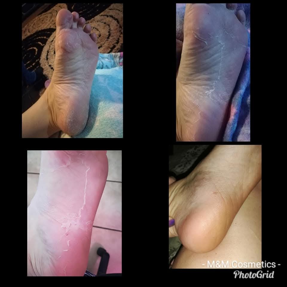 Magdala Skincare - Repair Heel Balm Treatment