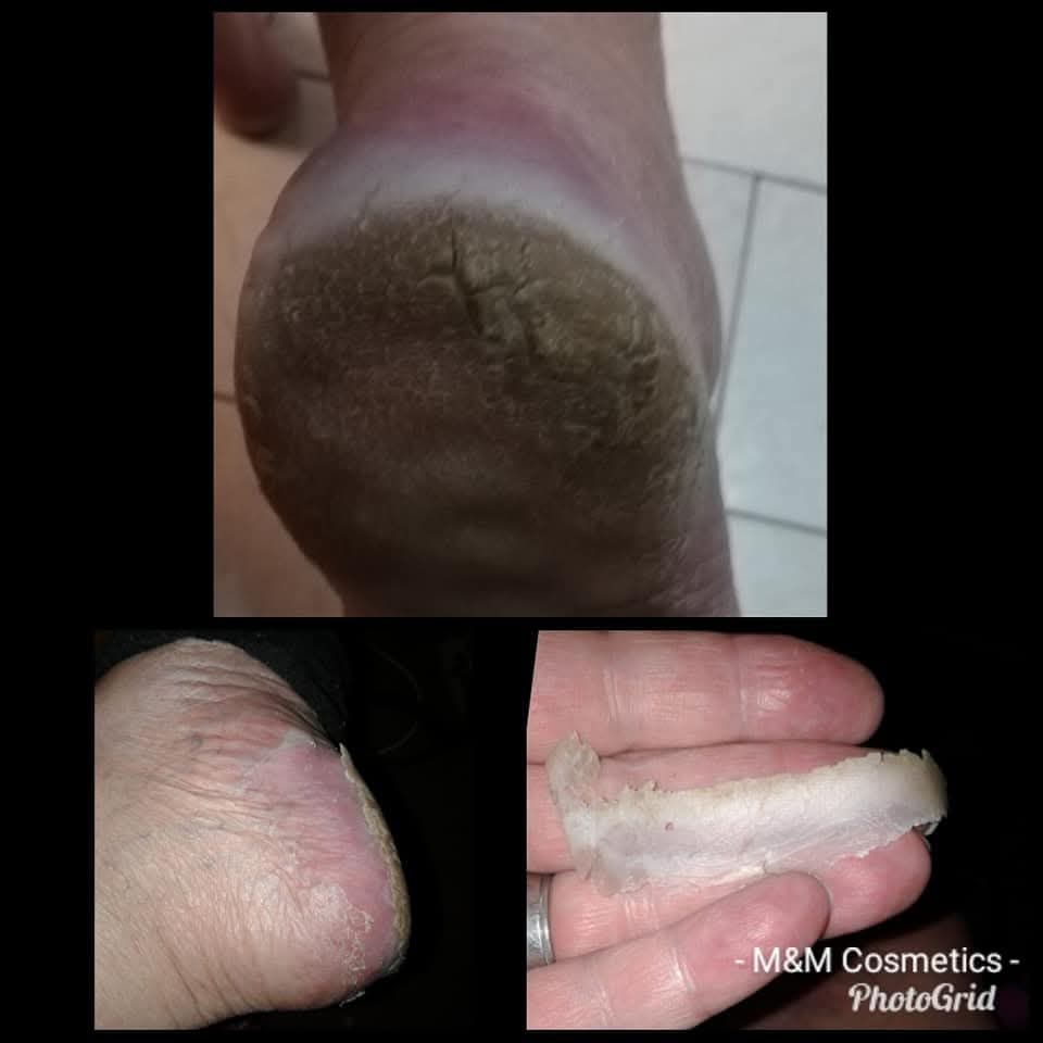 Magdala Skincare - Repair Heel Balm Treatment